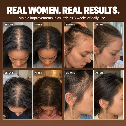 Permanently Reverse Hair Loss or Your Money Back
