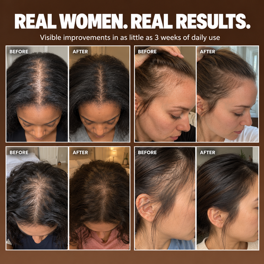Permanently Reverse Hair Loss or Your Money Back