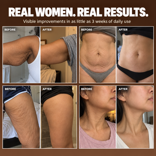 Permanently Tighten Your Skin or Your Money Back
