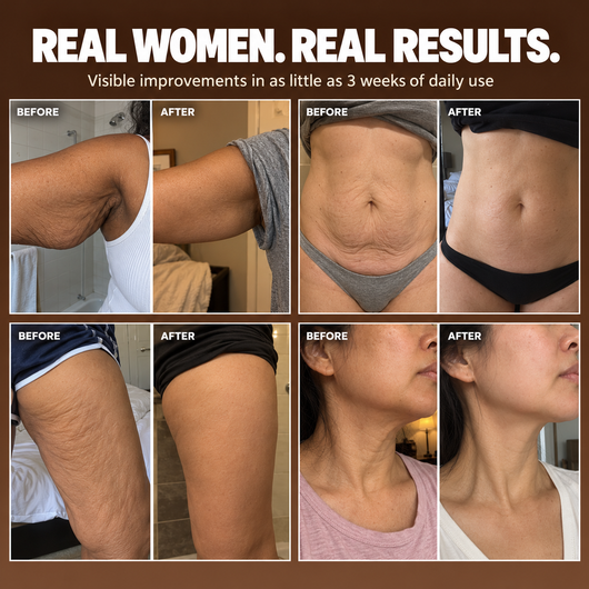 Permanently Tighten Your Skin or Your Money Back